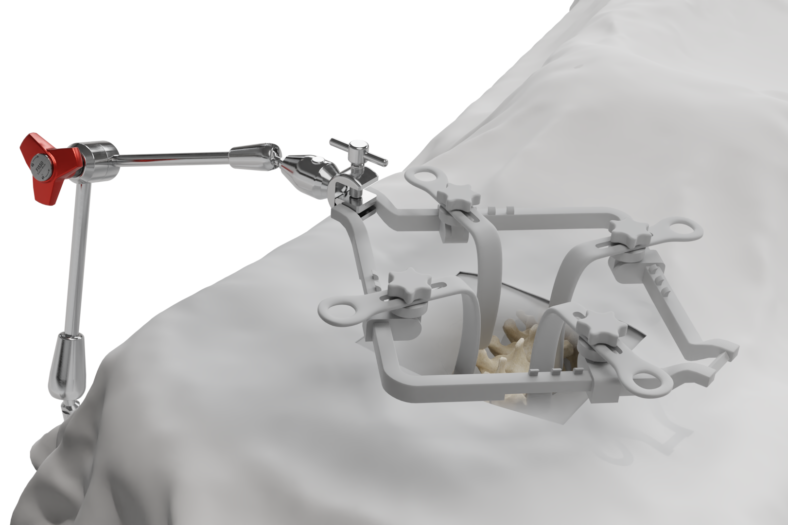 FISSO ring system illustrated with various rings and parts on a plain backdrop for clarity.